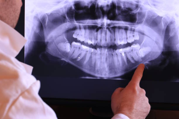 Best Broken Tooth Emergency  in Brittany Farms The Highlands, PA